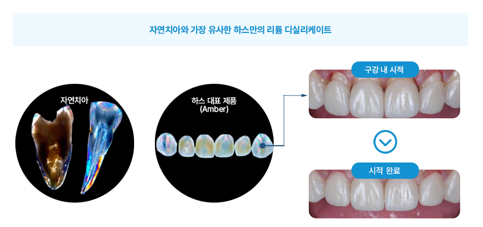 치아 관련 사진