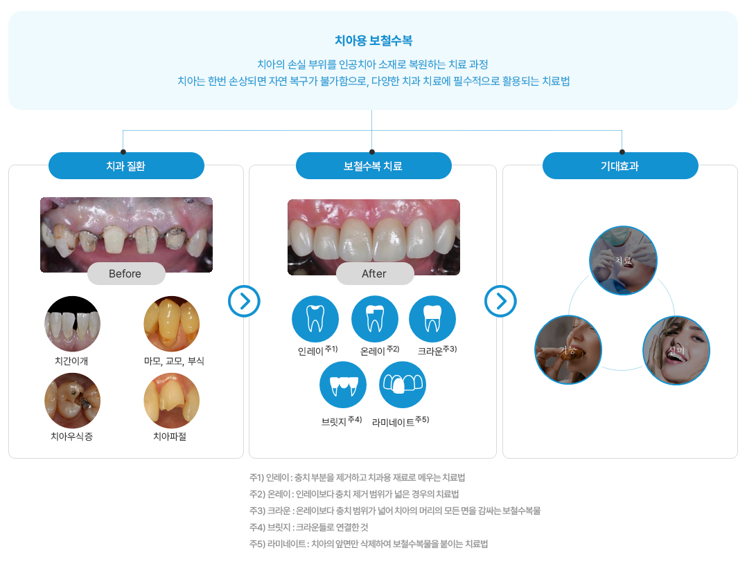 치아 구조