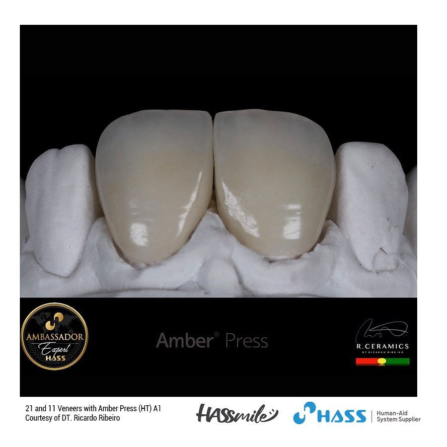 21 and 11 Veneers with Amber Press (HT) A1