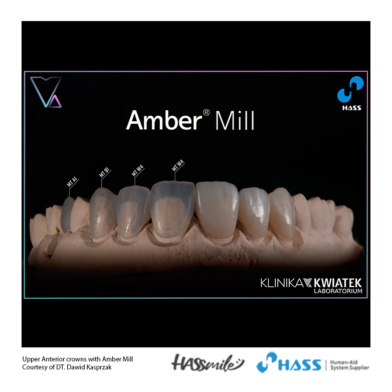 Upper Anterior crowns with Amber Mill