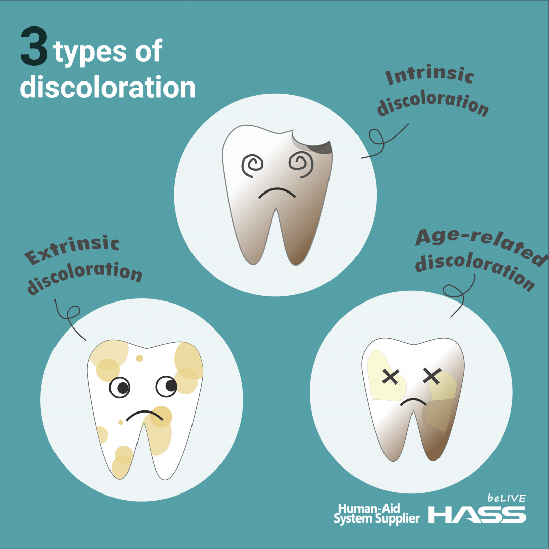 dental news tooth discoloration
