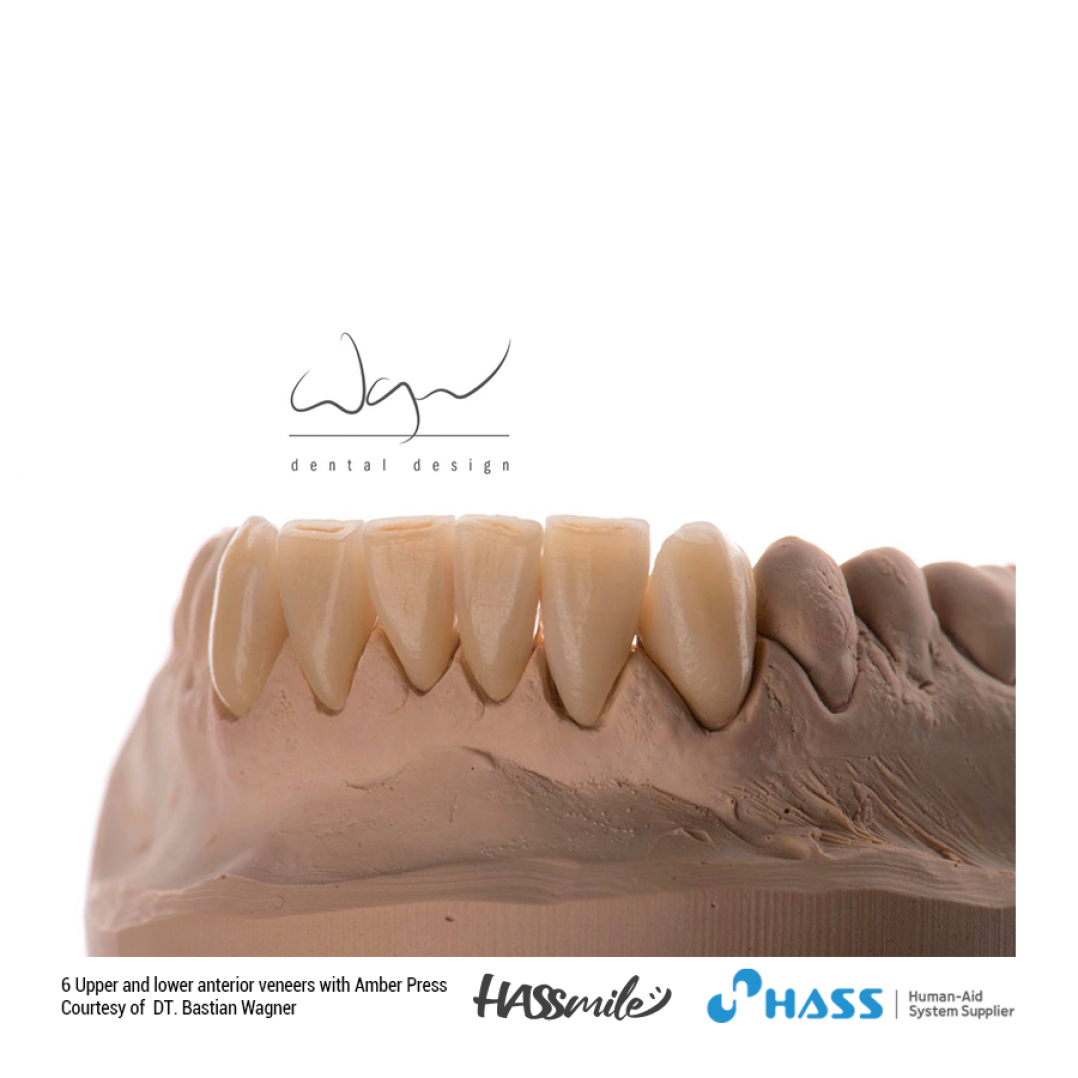 HASSBIO AmberPress Lithium-disilicate dental-press HASSmile