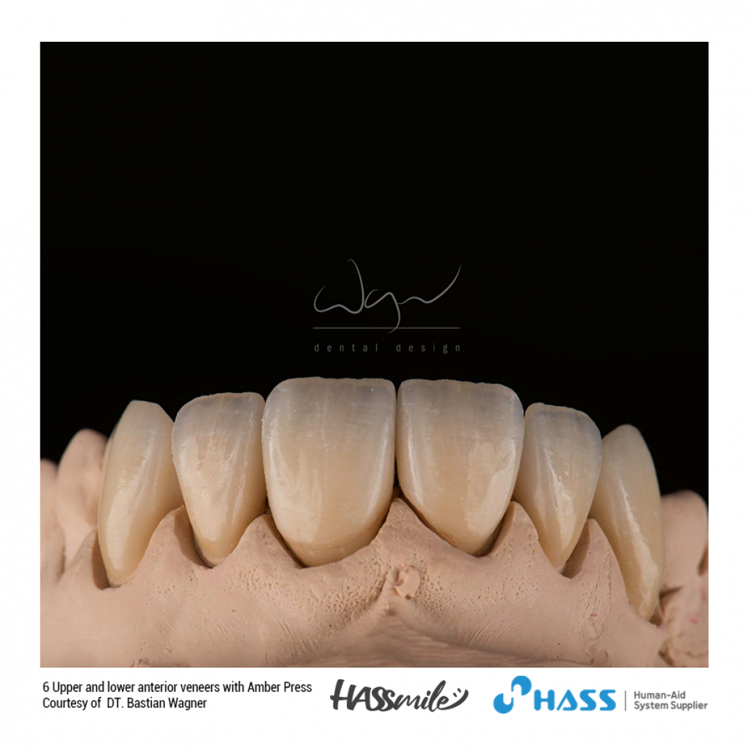 HASSBIO AmberPress Lithium-disilicate dental-press HASSmile