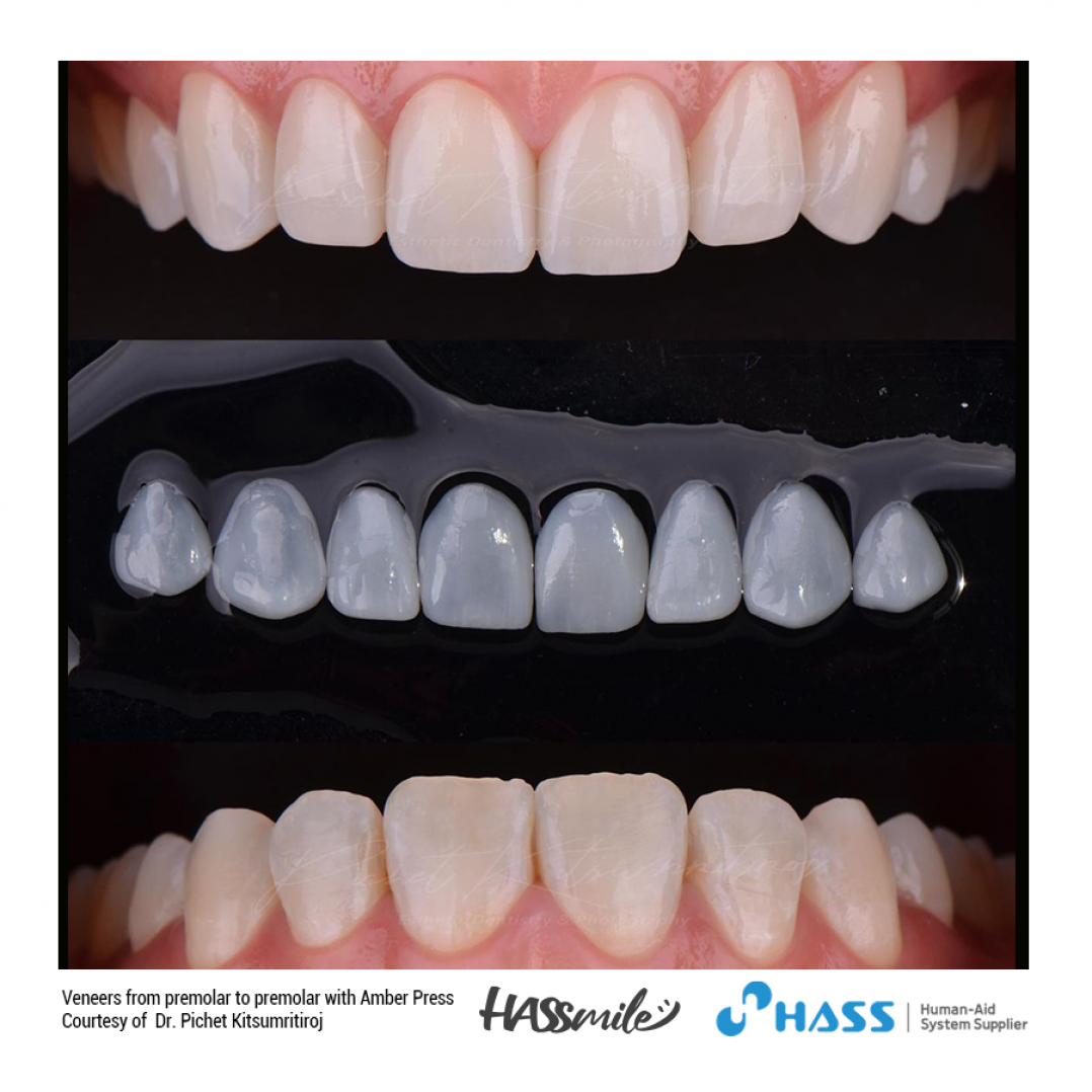 HASSBIO AmberPress dental-press Lithium-disilicate