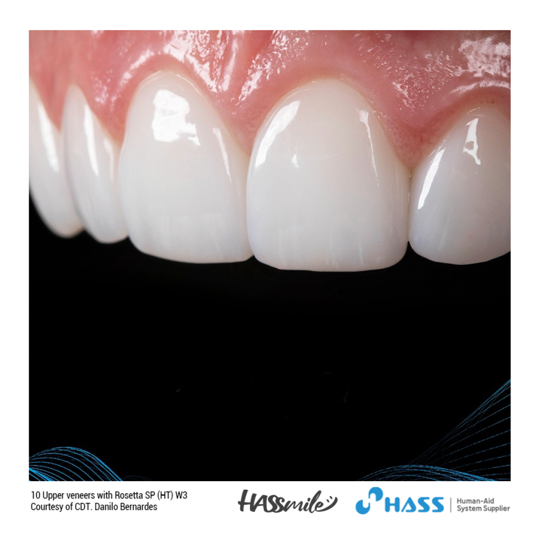 HASSBIO RosettaSP dental-press Lithium-disilicate
