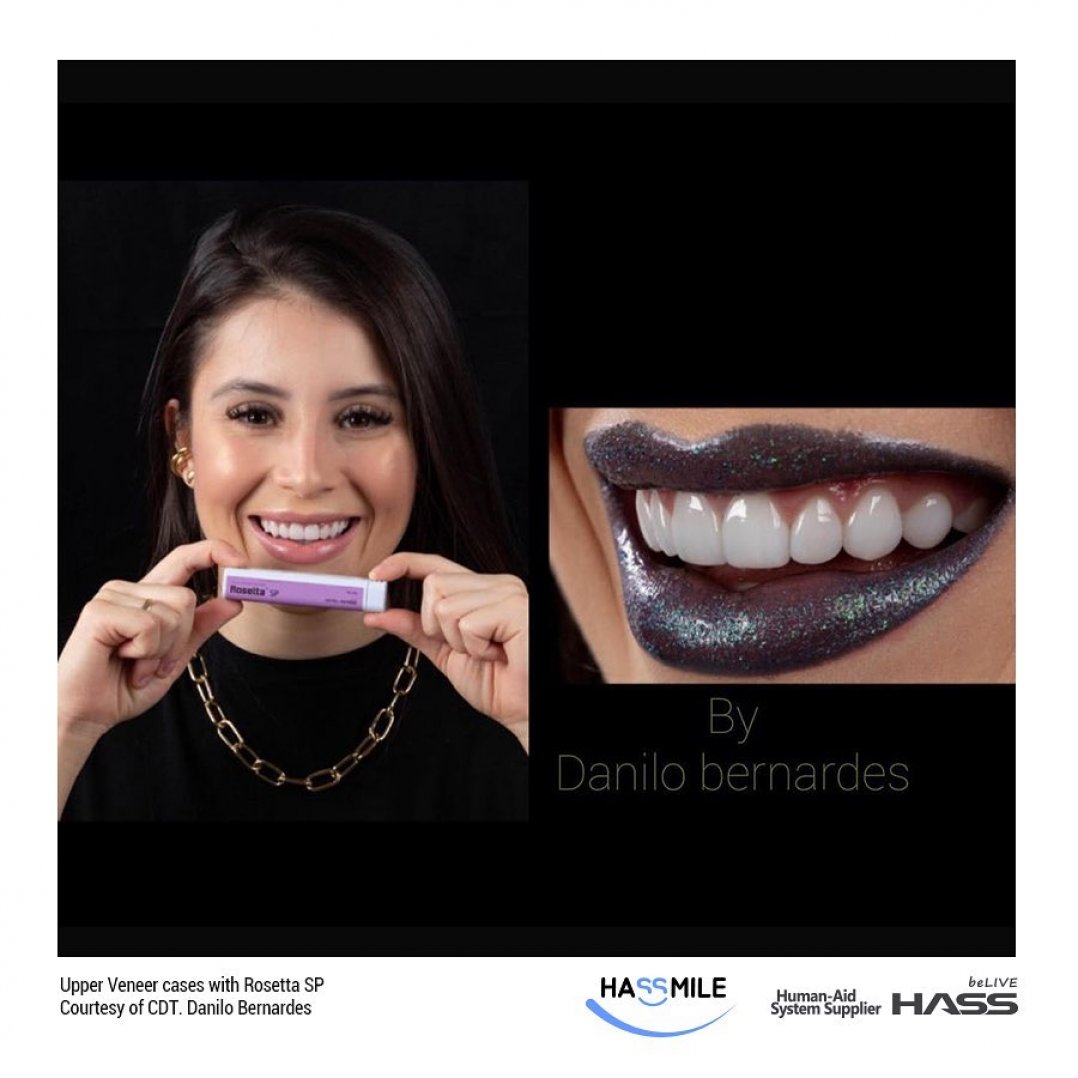 HASSBIO RosettaSP Lithium-disilicate dental-press-ingots